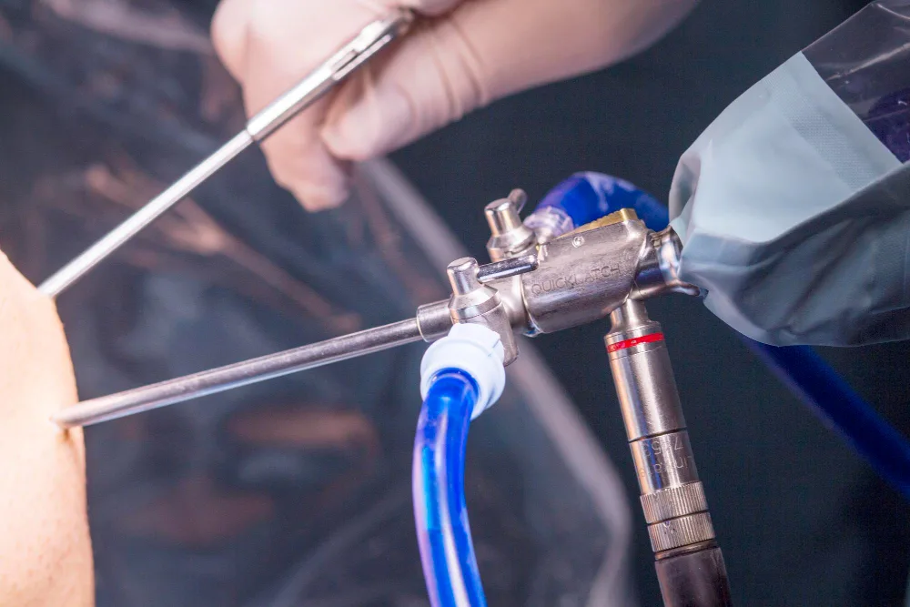 Artroscopia de cadera en Nuevo Leon