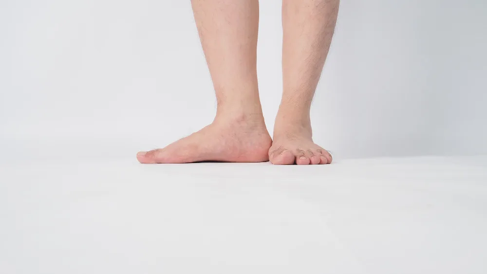 Consulta por pie plano en Nuevo Leon